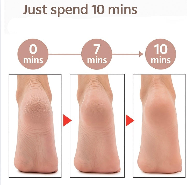 Summer Smooth Feet Kit FamSphere